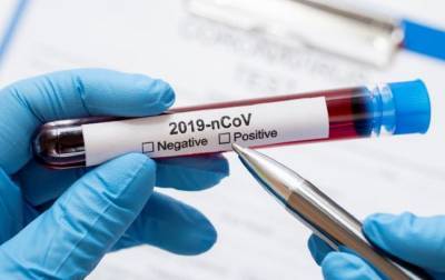 В Гослесагентстве обнаружили вспышку коронавируса