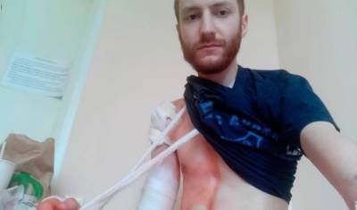 Суд оштрафовал журналиста Давида Френкеля, которому полицейский сломал руку