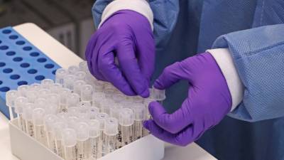 В России зарегистрировано 118 тест-систем для диагностики коронавируса