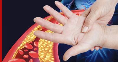 Ученые рассказали, как по состоянию рук определить уровень холестерина
