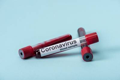 Уже более 16,7 млн человек заразились коронавирусом