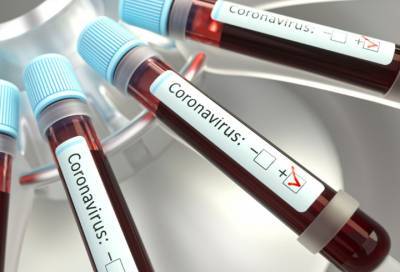 За последние сутки в России зафиксировали 5475 новых случаев коронавируса