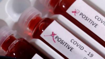 Вспышка коронавируса в КПИ: за сутки диагноз подтвердили у 81 курсанта