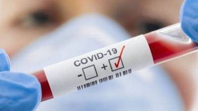 В Украине за сутки обнаружили 876 новых случаев COVID-19