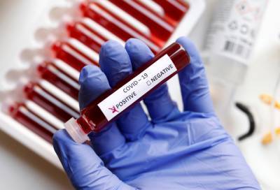 Новые случаи коронавируса выявлены в 14 районах Ленобласти