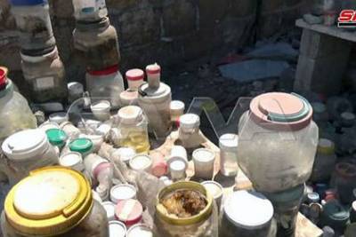 В Сирии нашли домашнюю лабораторию боевиков с человеческими органами