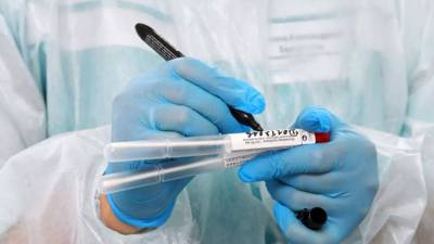 Более 27,8 млн тестов на коронавирус проведено в России