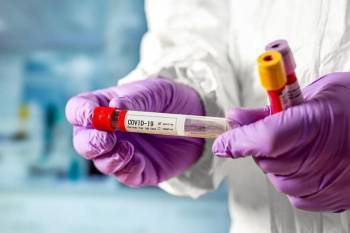 В России провели более 27,8 миллиона тестов на коронавирус