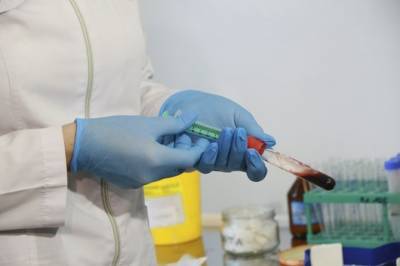 Житель Украины дважды переболел коронавирусом и заразился в третий раз