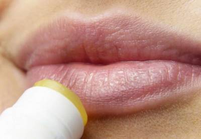 Медики назвали опасные последствия герпеса на губах