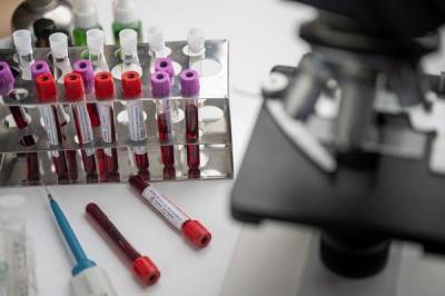 Более 28,1 млн тестов на коронавирус провели в России