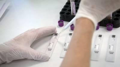 Более 28,1 млн тестов на коронавирус проведено в России