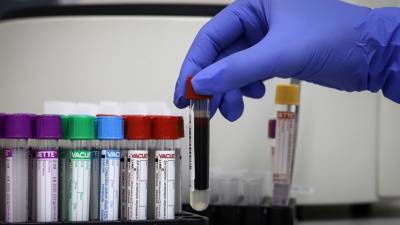 В Прикамье каждый восьмой житель сдал тест на коронавирус
