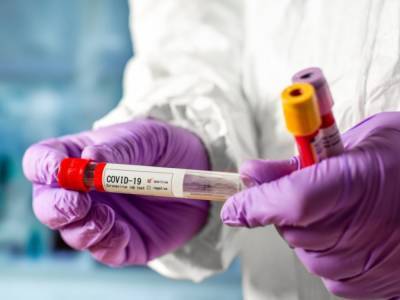 В Нацакадемии Украины составили прогноз развития пандемии коронавируса