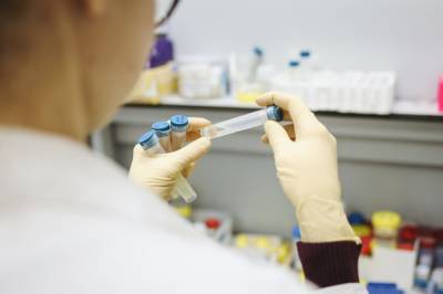 За прошедшие сутки в Украине зафиксировали 543 новых случаев коронавируса