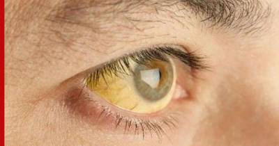 Необычный симптом опаснейшего вида рака нашли в глазах