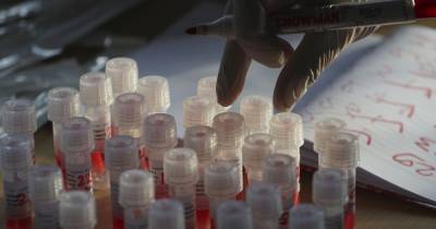 Украине передадут оборудование для усиления тестирований на коронавирус
