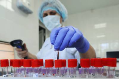 В ЦОЗ рассказали, сколько тестов на коронавирус провели за месяц