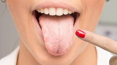 COVID-19 способен вызывать поражения полости рта