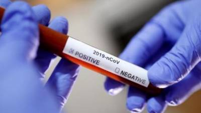 В Украине от коронавируса в течение суток умер 21 человек, зафиксировано 546 новых заражений