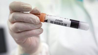 Число выздоровевших от коронавируса в России превысило 463 тыс. человек
