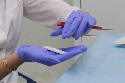 В Чувашии зафиксировали 67 новых заболевших коронавирусом, трое пациентов скончались