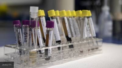 Ученые выявили еще один фактор, усугубляющий течение заболевания коронавирусом