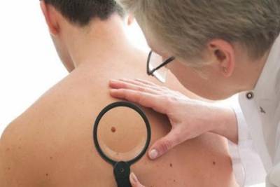 Врачи дали советы, как снизить риск рака кожи