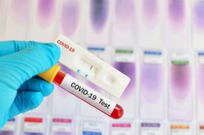 Новый рекорд выздоровевших и резкий скачок заболеваемости: в Минздраве дали актуальную статистику по COVID-19