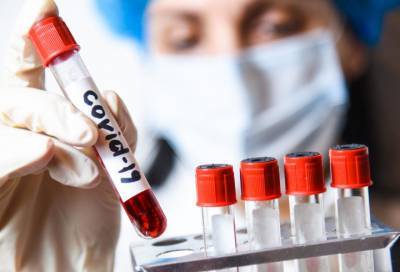В Ленобласти выявлено 50 новых случаев коронавируса
