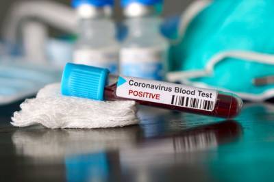 На Закарпатье после массовых гуляний зафиксировали вспышку коронавируса COVID-19