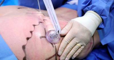 Убрать до 10 литров жировых отложений за одну процедуру с минимальной реабилитацией: что нового предлагают калининградцам пластические хирурги