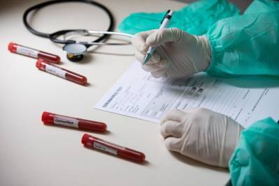 На Кубани выявили 63 новых случая заражения коронавирусом, в Адыгее – 20