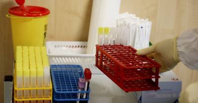 За сутки в Латвии -13 положительных тестов на новый коронавирус