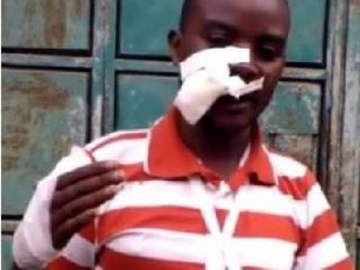 В Кении павиан сбросил местного жителя с крыши