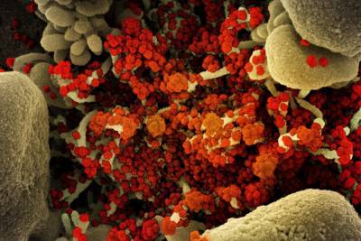 Ученые нашли 28 способных победить коронавирус антител