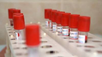 Россия отвечает на претензии отстающих конкурентов о разработанной вакцине против коронавируса