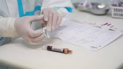 5 118 новых случаев коронавируса выявили в России за последние сутки