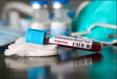 Новые случаи коронавируса выявили в 18 населенных пунктах Ленобласти