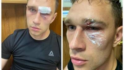 Футболист сборной России жестоко избил арбитра во время матча