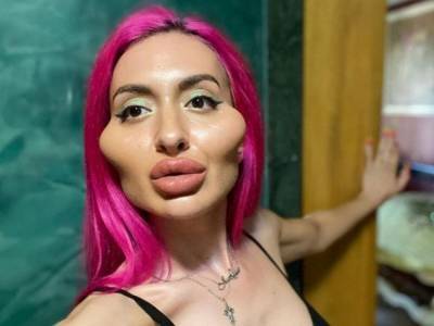 Украинка из телешоу сделала себе неестественные скулы и стала объектом критики в Сети