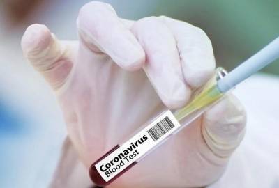 Россия получила заявки на поставку вакцины от COVID-19 более чем из 20 стран