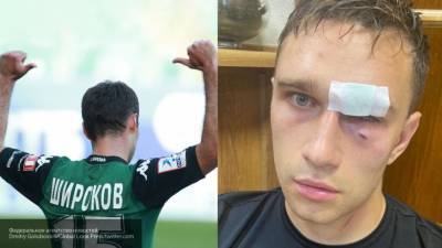 Избитый экс-футболистом Широковым арбитр обратился в полицию
