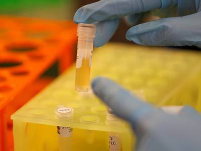 ВОЗ обсуждает с Россией дополнительную проверку ее вакцины от коронавируса