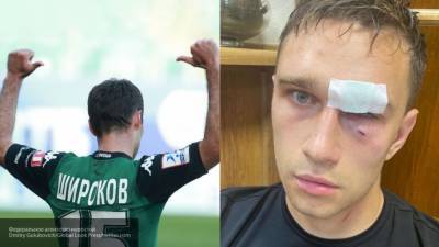 Избитый экс-футболистом Широковым во время матча судья обратился в полицию