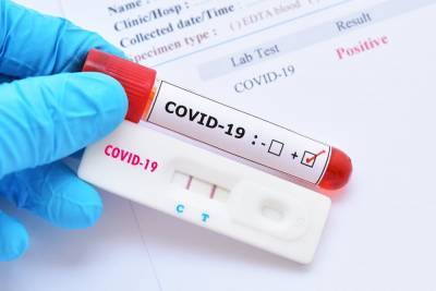 Коронавирус продолжает бить "рекорды": В Украине за сутки число больных COVID-19 выросло на 1 433