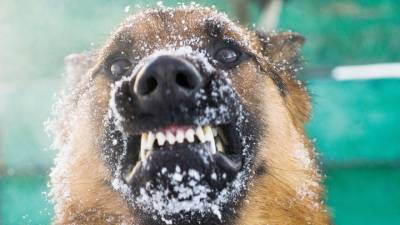 В Тольятти пострадавший от укуса бродячей собаки подросток получит 25 тысяч