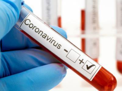 В Киеве коронавирус за сутки обнаружили у почти 200 человек - Кличко