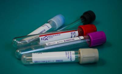 В ВСУ за минувшие сутки зафиксировали 34 новых случаев коронавируса