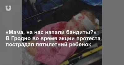 «Мама, на нас напали бандиты?» В Гродно во время акции протеста пострадал пятилетний ребенок